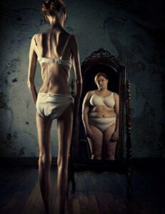 Anoressia